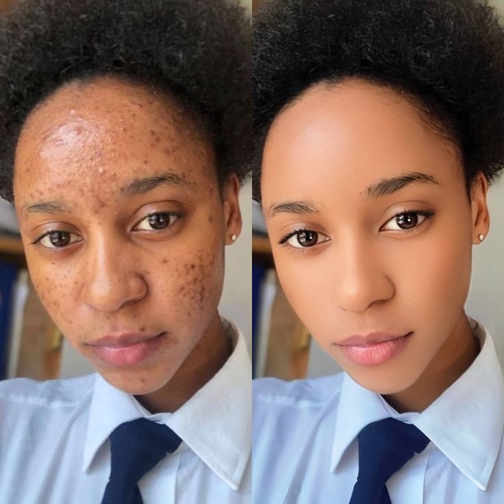 Before After Results